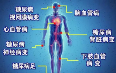 NOVIS如何作用血液调节血糖？听美国华裔科学家文学军教授怎么说