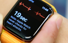 苹果AppleWatch成功检测出医院心电图遗漏的严重心脏问题 