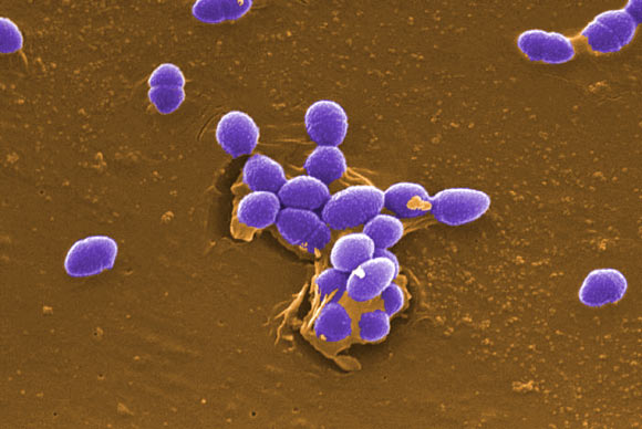 粪肠球菌（Enterococcus faecalis），一种在哺乳动物肠道中发现的机会性人类病原体。 图片来源：Pete Wardell / CDC。