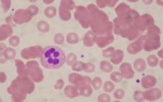 科普下正常的血细胞染色的反应