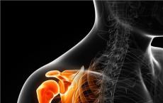 运动和PRP有望缓解脊髓损伤轮椅使用者的肩部疼痛