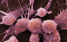 开展联合药物试验以根除B细胞恶性肿瘤