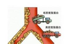 介绍下脂蛋白的类型：VLDL