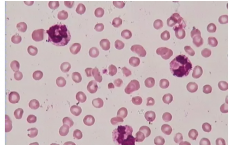 科普下正常血细胞碱性磷酸酶染色的反应