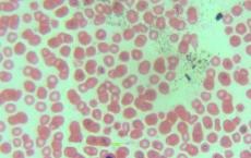 科普下正常血细胞α-NAE染色的反应