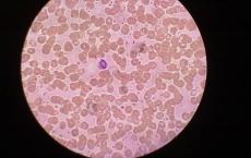 介绍下尿液红细胞形态检查