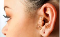 耳针疗法可作为药物滥用治疗者的辅助疗法