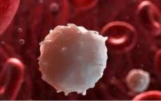 复合疗法对急性髓细胞性白血病有希望