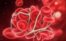介绍下止血的筛选试验：复钙时间测定