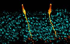 新发现的气道细胞可能为治疗囊性纤维化注入生命