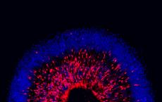 研究人员对人类干细胞进行建模以识别青光眼的变性