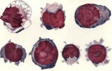 科普下巨核细胞系统有几种形态