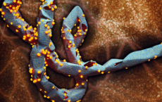 新研究揭示了阻止埃博拉病毒复制的方法