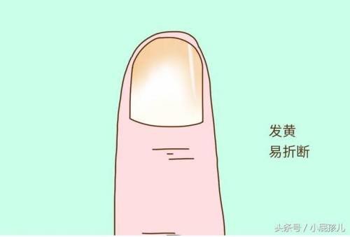 一般来说健康的手指甲是什么样子的