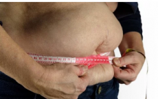研究人员认为肥胖应被视为过早衰老