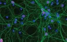 对鱿鱼的研究发现突触功能障碍ALS治疗的新途径