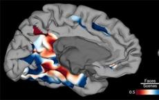 新研究确定大脑的哪些部分与面部和场景识别相关