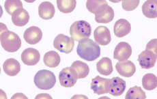 科学家发现疟原虫可能有自己的昼夜节律