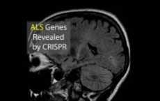 CRISPR在短短两周内扫描整个人类基因组的ALS突变