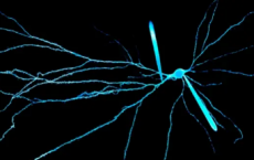 神经科学家现在可以记录人类神经元树突的电活动
