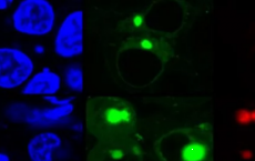 一种新的方法使用荧光来检测可能因疾病引起的蛋白质形式