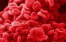 红细胞的三维形状与各种恶性血液疾病密切相关
