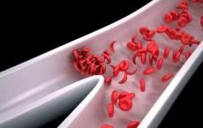 科学家发现扩张血管的蛋白质