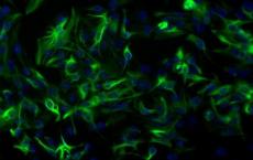 小胶质细胞和星形胶质细胞链接到化学脑