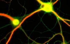 研究人员通过破译大脑皮层神经元的遗传程序 揭示了控制