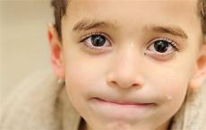 研究人员发现血压与幼儿眼睛健康有关