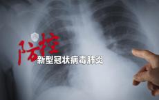CT可以为COVID-19提供最佳诊断