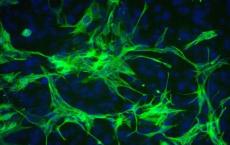 星形胶质细胞保护神经元免受毒性堆积