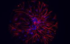 金纳米颗粒可拯救神经元免于细胞死亡