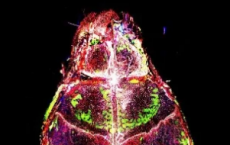 脑膜炎改变了小鼠脑内的免疫细胞组成