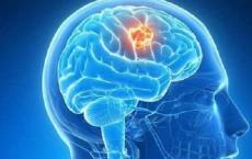 弗吉尼亚理工大学的科学家揭示脑肿瘤会影响正常有用的细