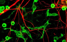 小鼠研究表明小胶质细胞在阿尔茨海默氏症中中断神经发生