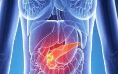科学家表明胰腺癌细胞的转移可以通过抑制调节细胞运动的