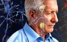 研究人员发现失去一夜的睡眠可能会增加阿尔茨海默氏症的