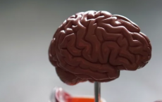 重叠的精神疾病具有独特的大脑特征