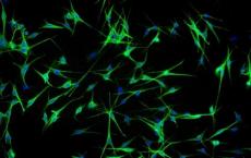 小胶质细胞激活对大脑有保护作用吗