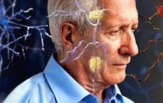 一个国际科学家团队已确认发现了痴呆的主要原因