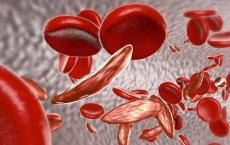 研究发现血液疾病的新型治疗方法