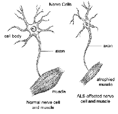 医学科学家已经鉴定出一种分子是一种治疗ALS的新化合物