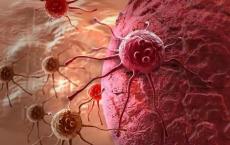 Mayo研究人员发现了引发癌症肿瘤进行免疫治疗的方法