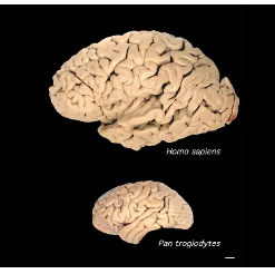 这些基因使人脑变得超大
