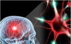 脑肿瘤类器官可能是胶质母细胞瘤时间敏感治疗的关键