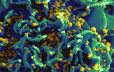 CRISPR治愈活体动物中的HIV