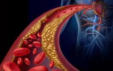 慢性肾脏病患者心血管不良结局的风险增加