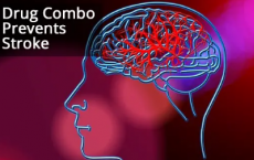 研究人员制造的最新药物组合可预防中风