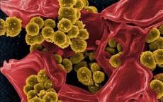 在非洲中部引起血液感染的沙门氏菌几乎对所有药物都有抵